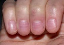Как выглядят здоровые ногти и как их внешний вид связан со здоровьем?