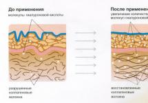 Что такое коллаген и его важность для кожи