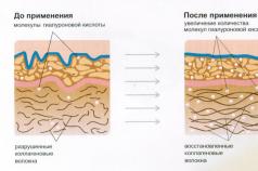 Что такое коллаген и его важность для кожи